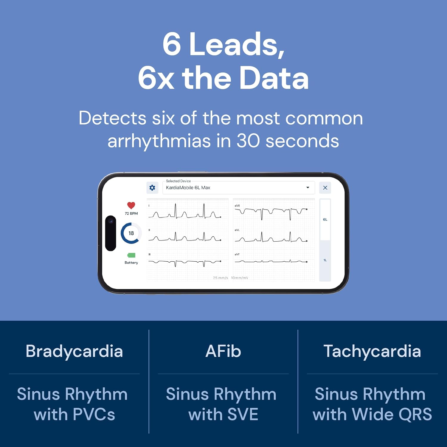 KardiaMobile 6L Max EKG Monitor, Includes One-Year KardiaCare Subscription, FDA-Cleared Heart Monitor, Medical-Grade Results in 30 Seconds, Unlimited Recordings, Works with Smartphones and Tablets